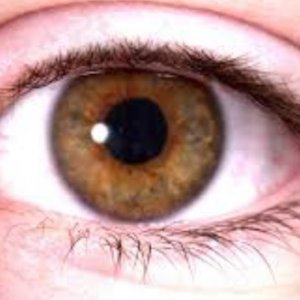 Göz kontrolüne dikkat edin: Uzun süreli kortizon kullanımı glokoma yol açıyor