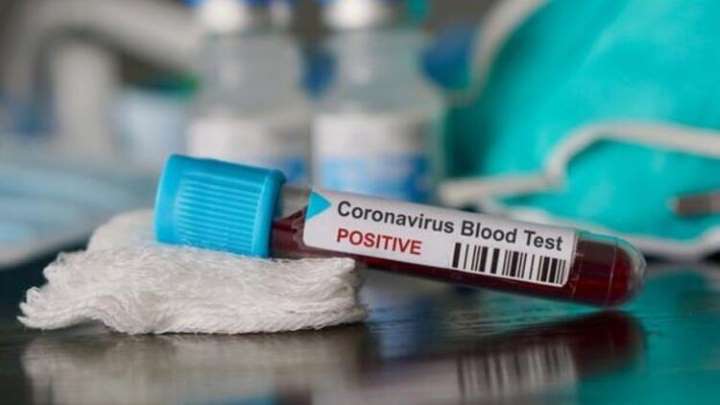 Koronavirüs’te bugün ne oldu? Vaka sayısı 5.5 milyona yaklaştı
